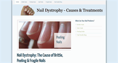 Desktop Screenshot of naildystrophy.com